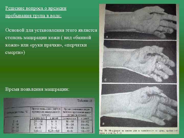 Решение вопроса о времени пребывания трупа в воде: Основой для установления этого является степень