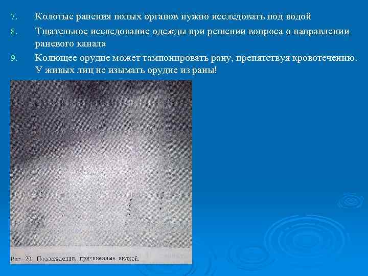 7. 8. 9. Колотые ранения полых органов нужно исследовать под водой Тщательное исследование одежды