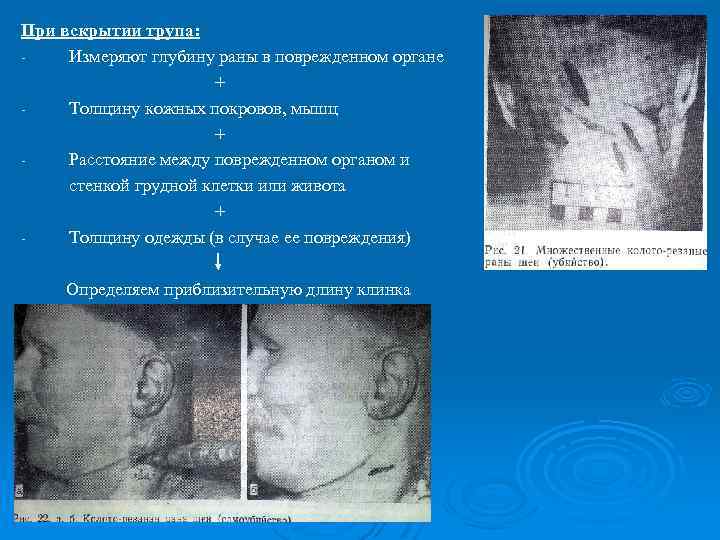 При вскрытии трупа: Измеряют глубину раны в поврежденном органе + Толщину кожных покровов, мышц