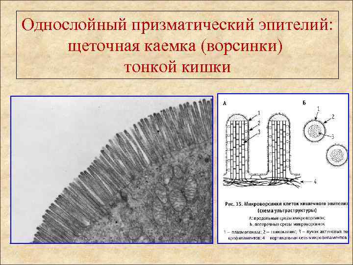 Однослойный призматический эпителий: щеточная каемка (ворсинки) тонкой кишки 