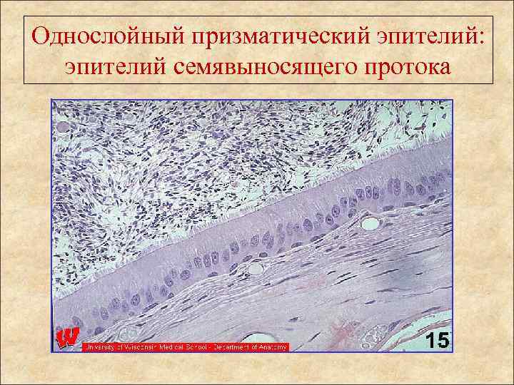 Однослойный призматический эпителий: эпителий семявыносящего протока 