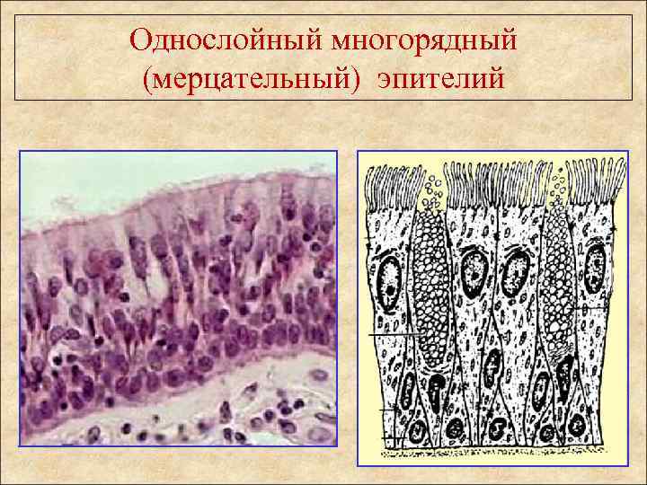 Мерцательный эпителий рисунок