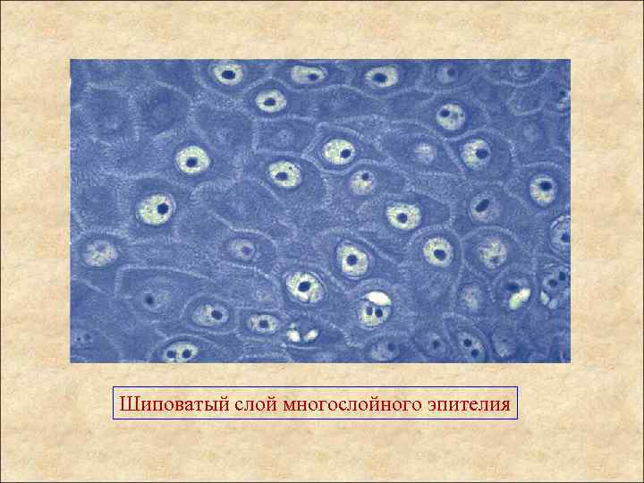 Шиповатый слой многослойного эпителия 