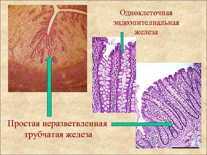 Одноклеточная эндоэпителиальная железа Простая неразветвленная трубчатая железа 