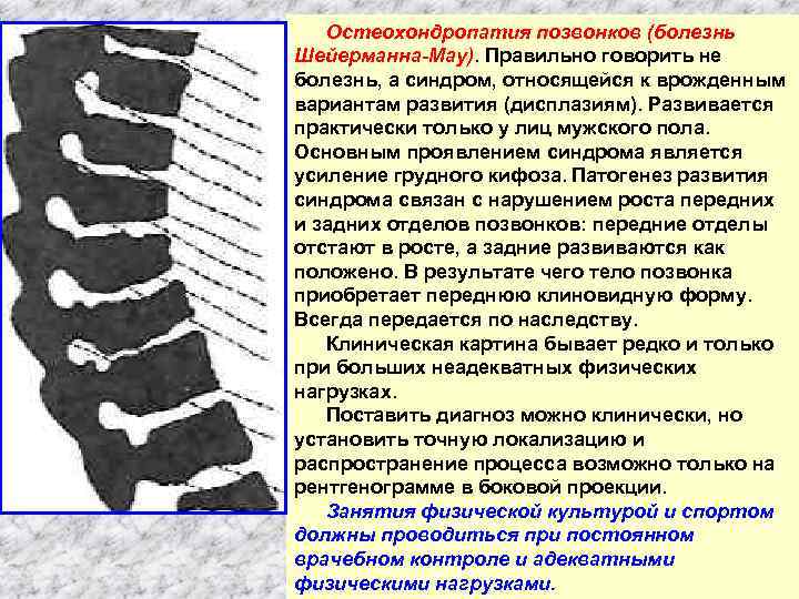 Остеохондропатия позвонков (болезнь Шейерманна-Мау). Правильно говорить не болезнь, а синдром, относящейся к врожденным вариантам