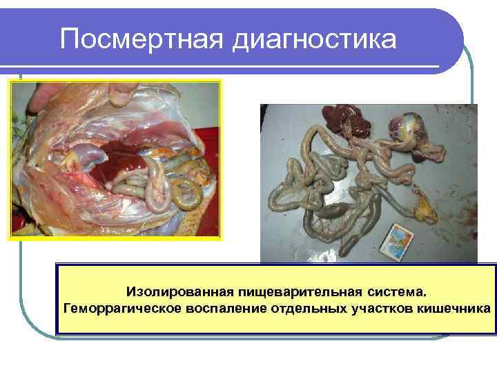 Посмертная диагностика Изолированная пищеварительная система. Геморрагическое воспаление отдельных участков кишечника 