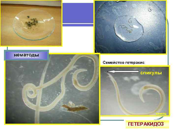 нематоды Семейство гетеракис спикулы самец ГЕТЕРАКИДОЗ 