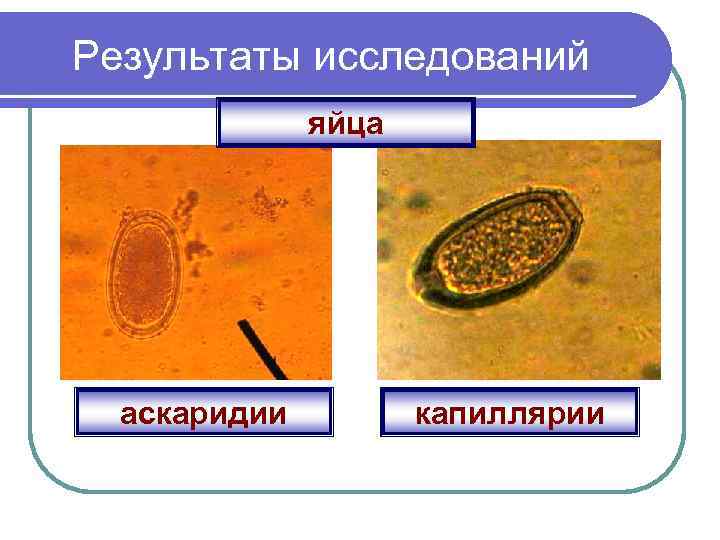 Результаты исследований яйца аскаридии капиллярии 