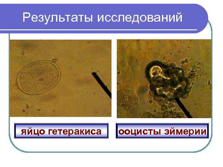 Результаты исследований яйцо гетеракиса ооцисты эймерии 