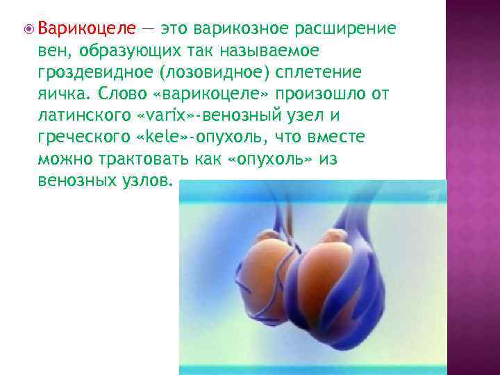  Варикоцеле — это варикозное расширение вен, образующих так называемое гроздевидное (лозовидное) сплетение яичка.