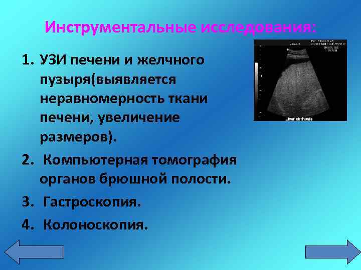 Инструментальные исследования: 1. УЗИ печени и желчного пузыря(выявляется неравномерность ткани печени, увеличение размеров). 2.