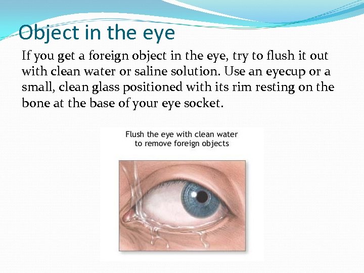 Object in the eye If you get a foreign object in the eye, try