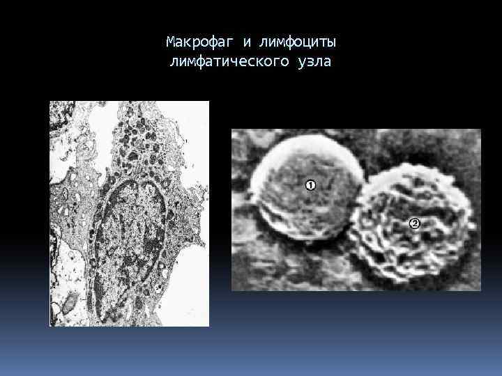 Макрофаг и лимфоциты лимфатического узла 