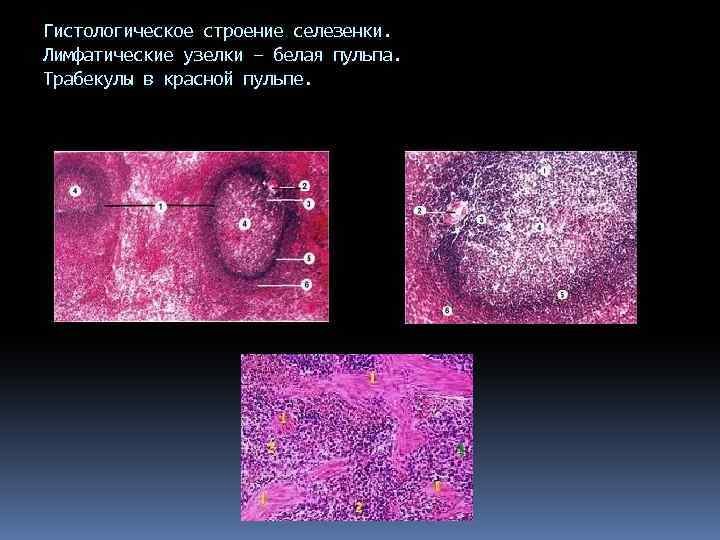 Гистологическое строение селезенки. Лимфатические узелки – белая пульпа. Трабекулы в красной пульпе. 