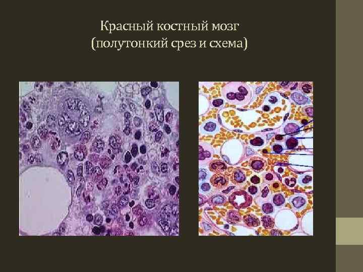 Красный костный мозг (полутонкий срез и схема) 