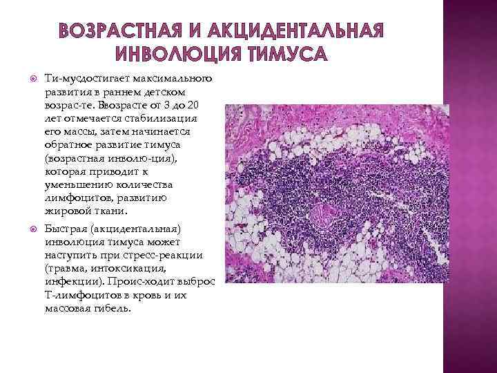 ВОЗРАСТНАЯ И АКЦИДЕНТАЛЬНАЯ ИНВОЛЮЦИЯ ТИМУСА Ти мусдостигает максимального развития в раннем детском возрас те.