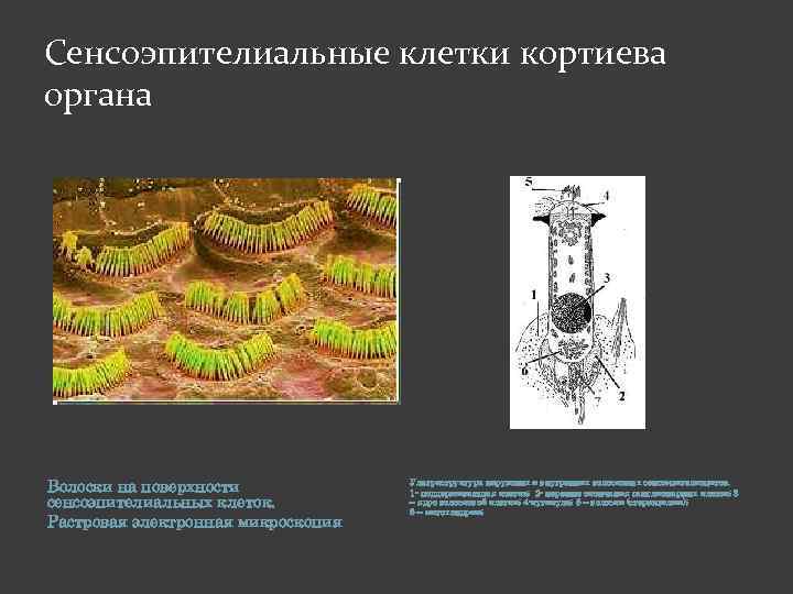 Сенсоэпителиальные клетки кортиева органа Волоски на поверхности сенсоэпителиальных клеток. Растровая электронная микроскопия Ультраструктура наружных