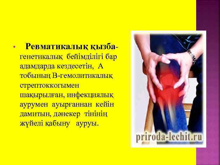  • Ревматикалық қызба- генетикалық бейімділігі бар адамдарда кездесетін, А тобының В-гемолитикалық стрептоккогымен шақырылған,