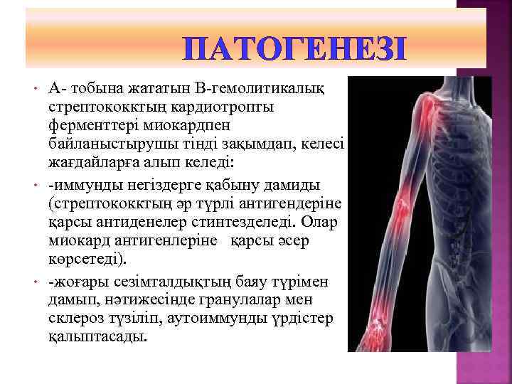 ПАТОГЕНЕЗІ • • • А- тобына жататын В-гемолитикалық стрептококктың кардиотропты ферменттері миокардпен байланыстырушы тінді