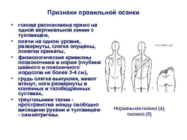 Признаки правильной осанки • голова расположена прямо на одной вертикальной линии с туловищем, •