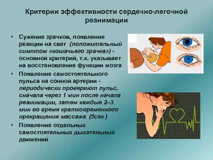 Критерии эффективности сердечно-легочной реанимации • Сужение зрачков, появление реакции на свет (положительный симптом «кошачьего