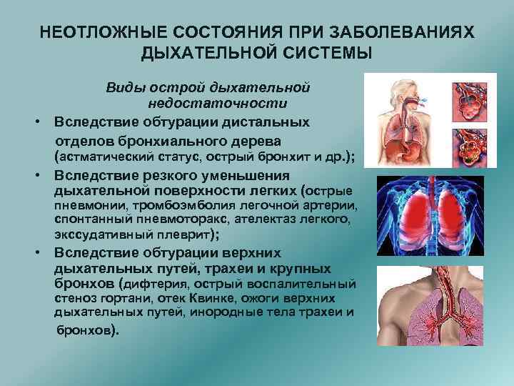 НЕОТЛОЖНЫЕ СОСТОЯНИЯ ПРИ ЗАБОЛЕВАНИЯХ ДЫХАТЕЛЬНОЙ СИСТЕМЫ Виды острой дыхательной недостаточности • Вследствие обтурации дистальных