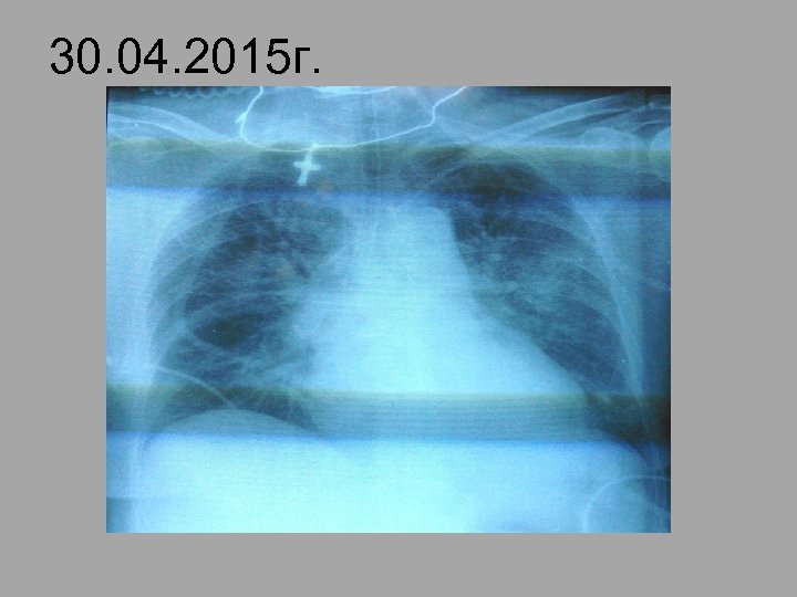 30. 04. 2015 г. 