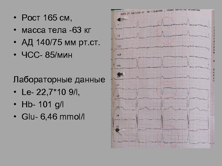  • • Рост 165 см, масса тела -63 кг АД 140/75 мм рт.