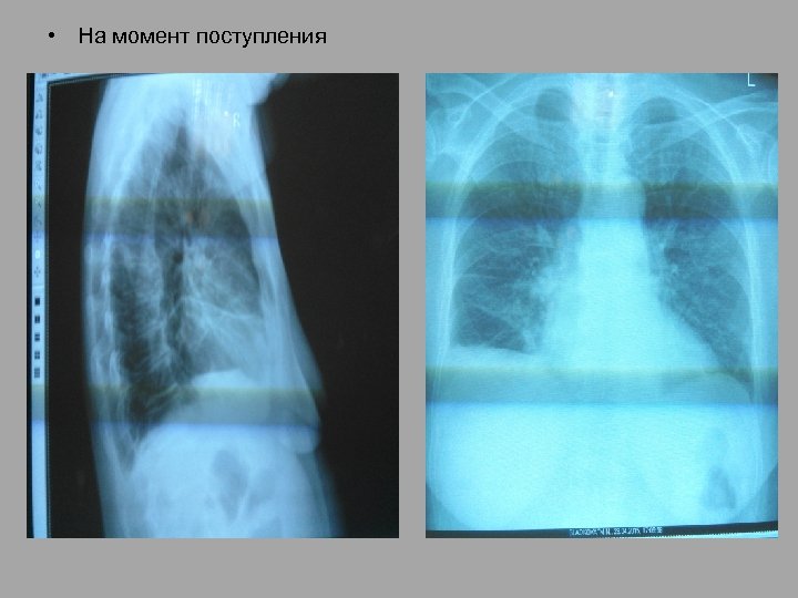  • На момент поступления 