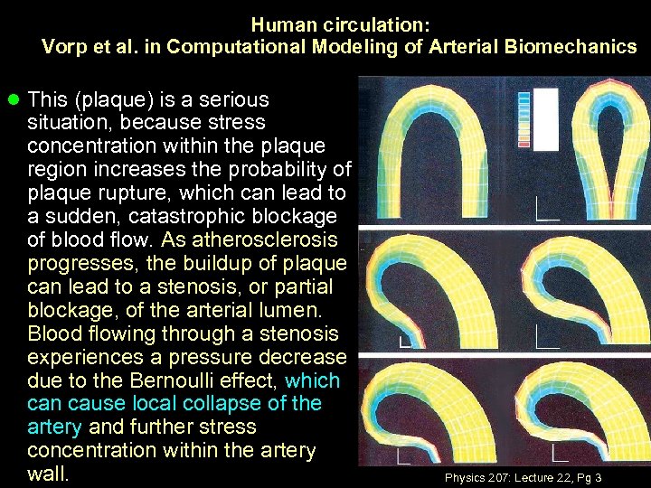 Human circulation: Vorp et al. in Computational Modeling of Arterial Biomechanics l This (plaque)
