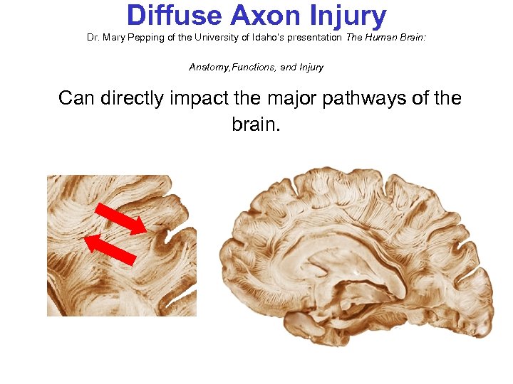 Diffuse Axon Injury Dr. Mary Pepping of the University of Idaho’s presentation The Human