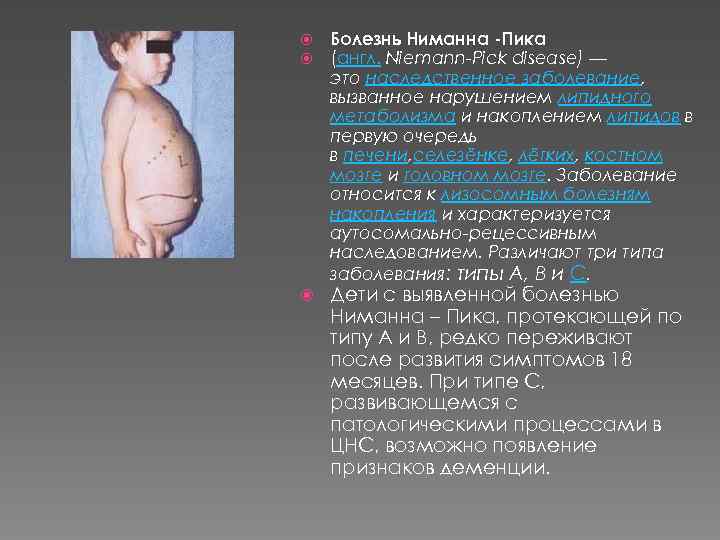  Болезнь Ниманна -Пика (англ. Niemann-Pick disease) — это наследственное заболевание, вызванное нарушением липидного