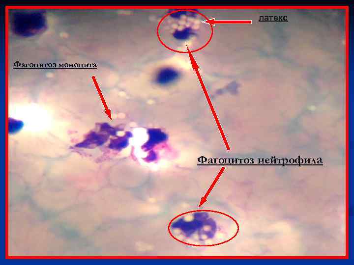 латекс Фагоцитоз моноцита Фагоцитоз нейтрофила 