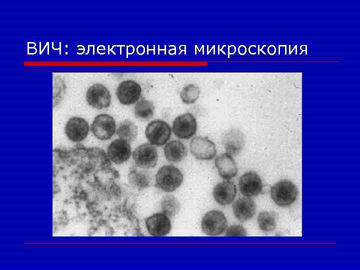 ВИЧ: электронная микроскопия 