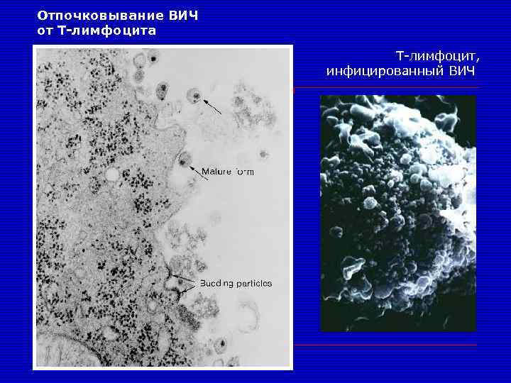 Отпочковывание ВИЧ от Т-лимфоцита Т-лимфоцит, инфицированный ВИЧ 