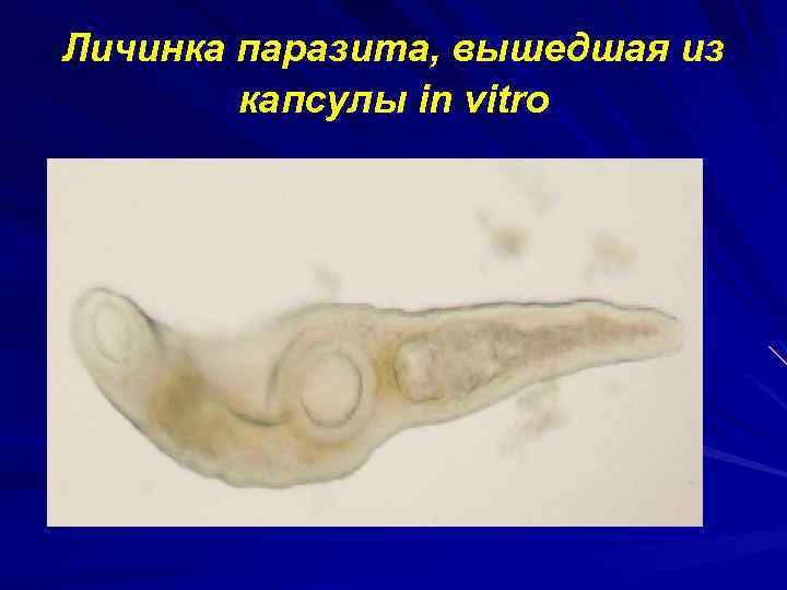 Личинка паразита, вышедшая из капсулы in vitro 