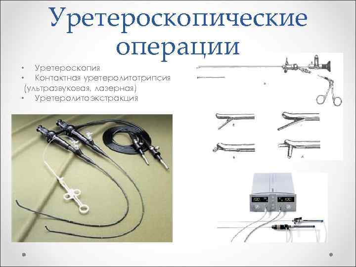 Уретероскопические операции • Уретероскопия • Контактная уретеролитотрипсия (ультразвуковая, лазерная) • Уретеролитоэкстракция 