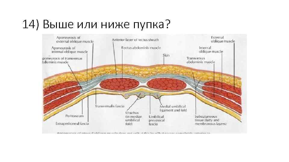 14) Выше или ниже пупка? 