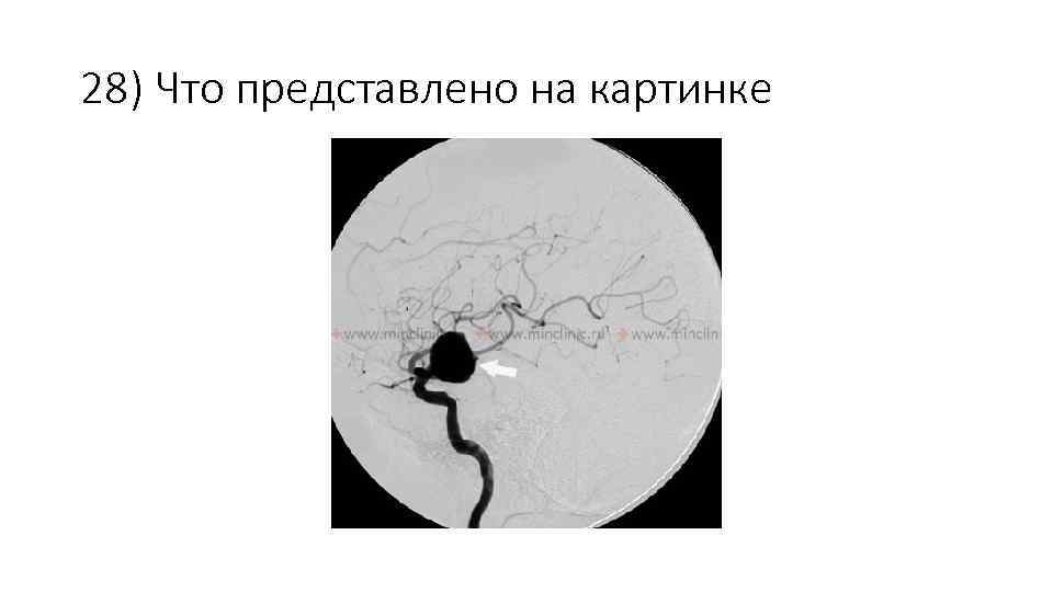 28) Что представлено на картинке 