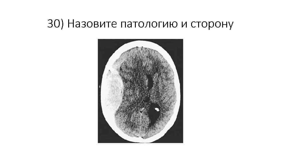 30) Назовите патологию и сторону 