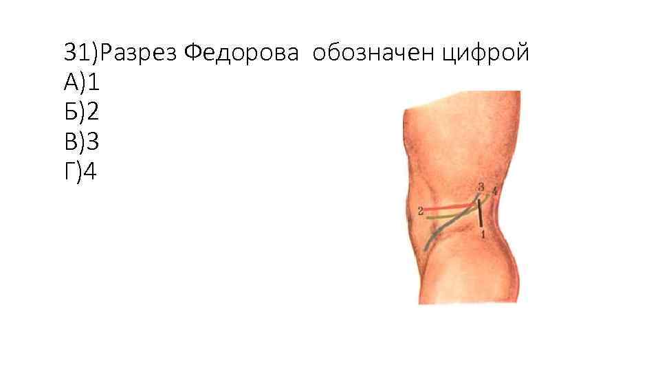 31)Разрез Федорова обозначен цифрой А)1 Б)2 В)3 Г)4 