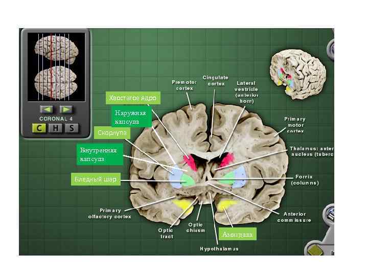 Хвостатое ядро Наружная капсула Скорлупа Внутренняя капсула Бледный шар Амигдала 