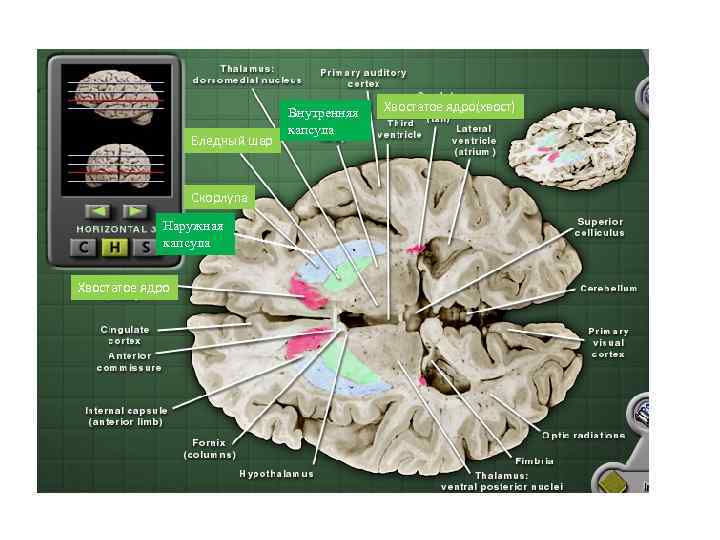 Бледный шар Скорлупа Наружная капсула Хвостатое ядро Внутренняя капсула Хвостатое ядро(хвост) 