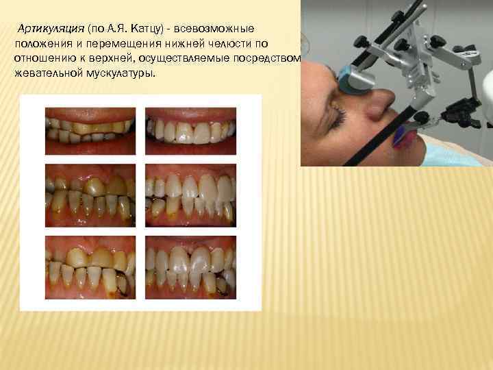 Методы исследования артикуляции презентация