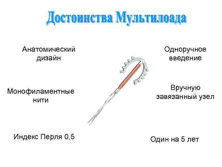 Анатомический дизайн Монофиламентные нити Индекс Перля 0, 5 Одноручное введение Вручную завязанный узел Один