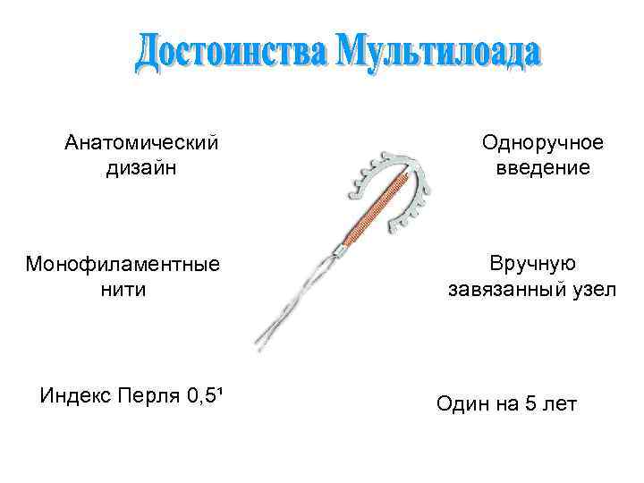 Анатомический дизайн Монофиламентные нити Индекс Перля 0, 5¹ Одноручное введение Вручную завязанный узел Один