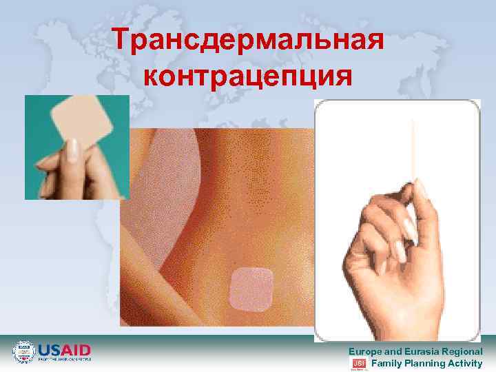 Трансдермальная контрацепция Europe and Eurasia Regional Family Planning Activity 