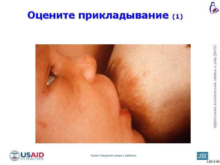 (1) Эффективная антенатальная помощь и уход (ЭАПУ) Оцените прикладывание Проект «Здоровье матери и ребенка»