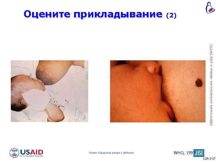 (2) Эффективная антенатальная помощь и уход (ЭАПУ) Оцените прикладывание Проект «Здоровье матери и ребенка»