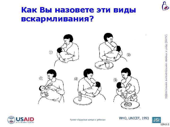 Эффективная антенатальная помощь и уход (ЭАПУ) Как Вы назовете эти виды вскармливания? Проект «Здоровье